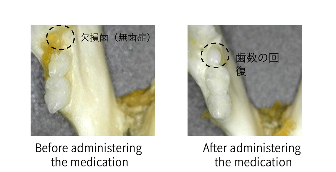 Japanese researchers work on tooth regrowth drug — Heapio